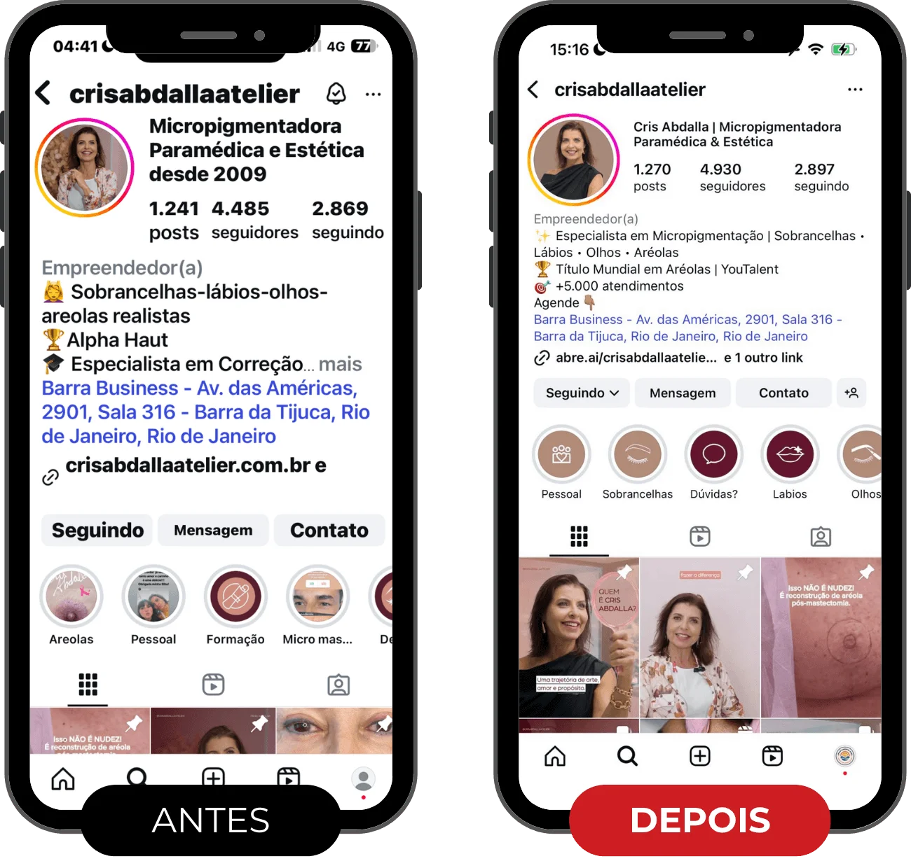 antes e depois clientes fernanda (3) (1)
